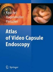 Atlas of Video Capsule Endoscopy
