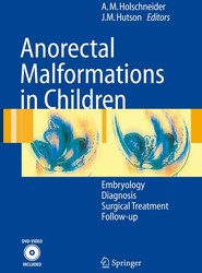 Anorectal Malformations in Children