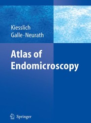 Atlas of Endomicroscopy