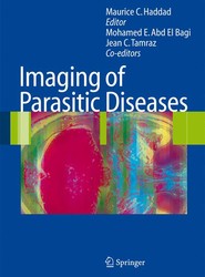 Imaging of Parasitic Diseases