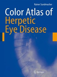 Color Atlas of Herpetic Eye Disease