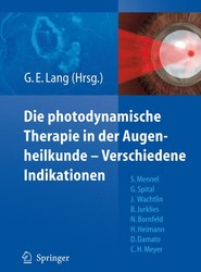 Die photodynamische Therapie in der Augenheilkunde - Verschiedene Indikationen