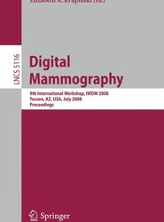 Digital Mammography