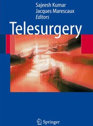 Telesurgery