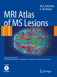 MRI Atlas of MS Lesions