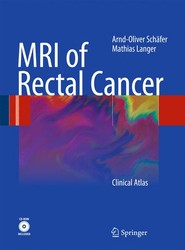 MRI of Rectal Cancer