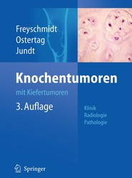 Knochentumoren mit Kiefertumoren