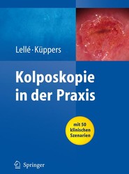 Kolposkopie in der Praxis