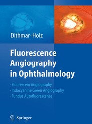 Fluorescence Angiography in Ophthalmology
