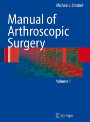 Manual of Arthroscopic Surgery