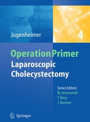 Laparoscopic Cholecystectomy