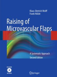 Raising of Microvascular Flaps