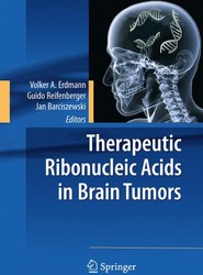 Therapeutic Ribonucleic Acids in Brain Tumors