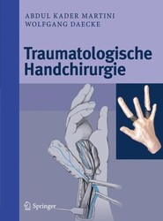 Traumatologische Handchirurgie