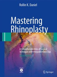 Mastering Rhinoplasty