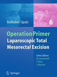Laparoscopic Total Mesorectal Excision