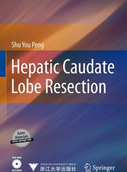 Hepatic Caudate Lobe Resection