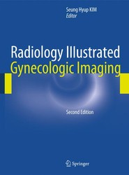 Radiology Illustrated: Gynecologic Imaging