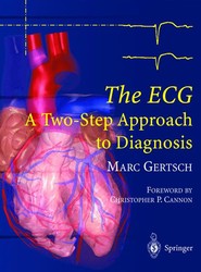 The ECG