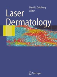 Laser Dermatology