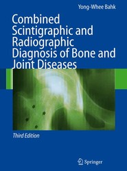 Combined Scintigraphic and Radiographic Diagnosis of Bone and Joint Diseases