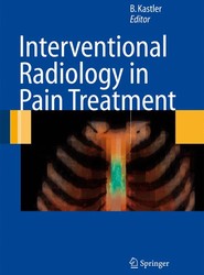 Interventional Radiology in Pain Treatment