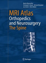 MRI Atlas