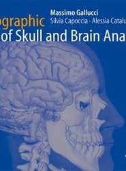 Radiographic Atlas of Skull and Brain Anatomy
