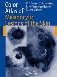Color Atlas of Melanocytic Lesions of the Skin
