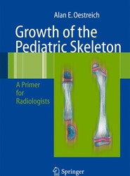 Growth of the Pediatric Skeleton
