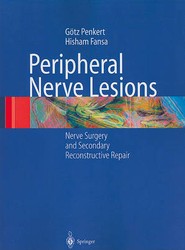 Peripheral Nerve Lesions