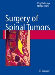 Surgery of Spinal Tumors