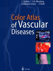 Color Atlas of Vascular Diseases