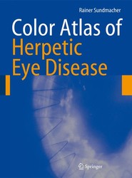 Color Atlas of Herpetic Eye Disease
