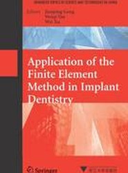 Application of the Finite Element Method in Implant Dentistry