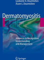Dermatomyositis