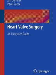 Heart Valve Surgery