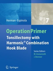 Tonsillectomy with Harmonic Technology