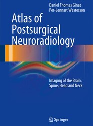 Atlas of Postsurgical Neuroradiology