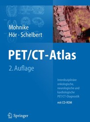PET/CT-Atlas