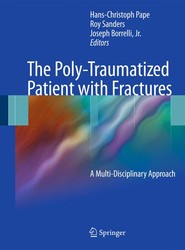 The Poly-Traumatized Patient with Fractures