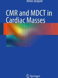 CMR and MDCT in Cardiac Masses