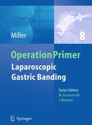 Laparoscopic Gastric Banding