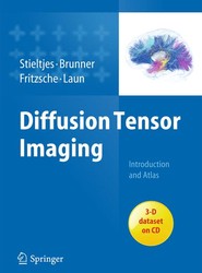 Diffusion Tensor Imaging