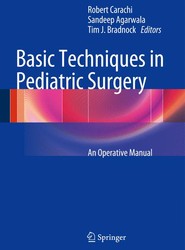 Basic Techniques in Pediatric Surgery