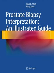 Prostate Biopsy Interpretation: An Illustrated Guide