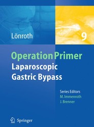 Laparoscopic Gastric Bypass