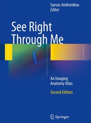 See Right Through Me