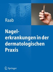 Nagelerkrankungen in der dermatologischen Praxis