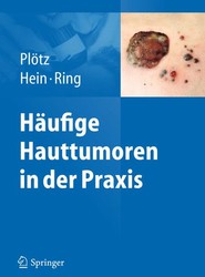 Häufige Hauttumoren in der Praxis